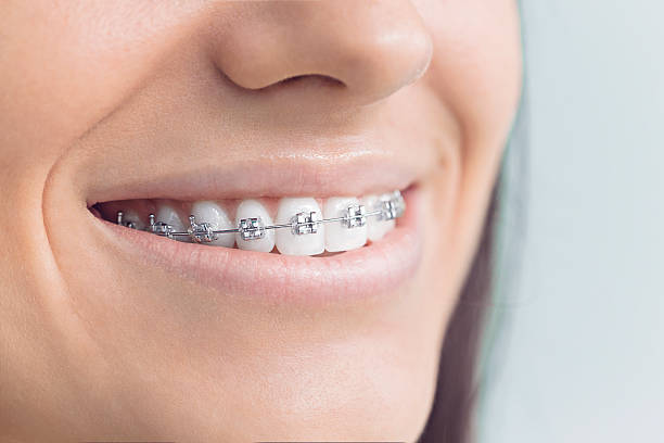 Best Tooth Extraction  in Gates Mills, OH
